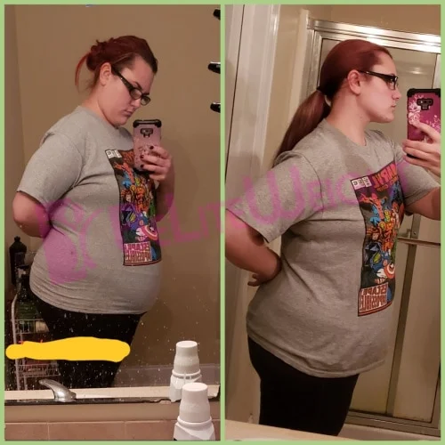 Weight Loss Surgery Before and After Jessica S - 5 Month Update*